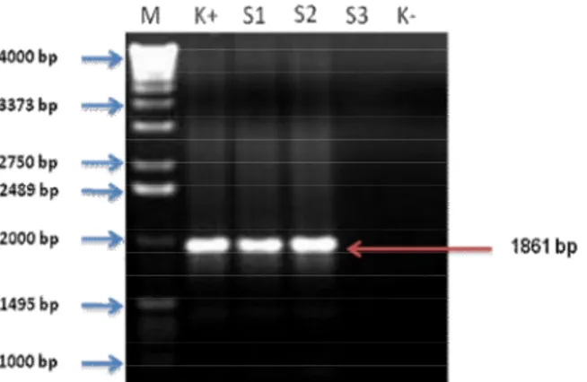 Gambar 5.  Amplifikasi  DNA  daun  abaka  transforman  dengan  PCR.   M  :  Marker  DNA  ladder  4  kb,  K+:  Kontrol  positif  (DNA 