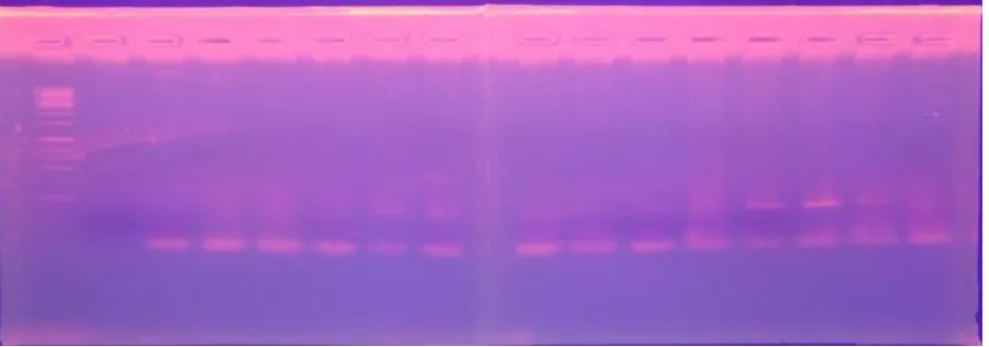 Gambar 1. Foto elektroforesis embrio hasil PCR, terlihat 2 ban yang menandakan jantan,(Y) dan yang 1 ban betina (X)