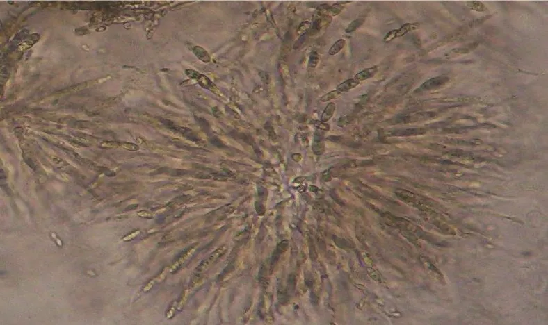 Gambar 8. Peritesium dari isolate yang termasuk MP-D (Gibberella intermedia                    (teliomorf), Fusarium proliferatum (anamorf)