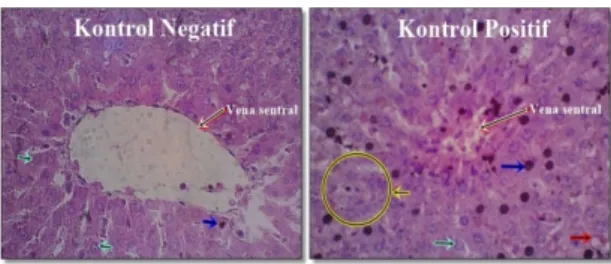 Gambar  1.  Histologi  hepar  tikus  wistar  dengan  pengecatan  HE  pada  kelompok  kontrol  negatif  (kiri)  dan kelompok kontrol positif (kanan) pada perbesaran  400x
