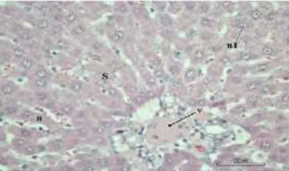 Gambar  6.  Penampang  Melintang  Histologi  Hati  pemberian  pegagan  dosis  6,25  mg/200  g  BB, n (sel kuffer), n1 (hepatosit menyimpang),  s (sinusoid melebar), v (vena sentralis) 
