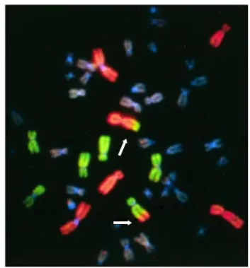 Gambar 1. Ilustrasi kromosom translokasi dengan teknik FISH. Kromosom no. 1, 2, dan 4 dicat merah dan  kromosom 3,4, dan 5 dicat hijau