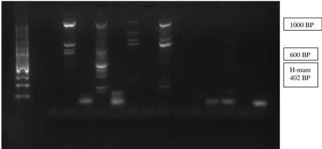 Gambar 4.1 Hasil Elektroforesis Mammaglobin (sampel 1-14)                X     C    1    2    3    4    5    6     7     8     9    10   11  12  13  14     Keterangan  X : Ladder  C : kontrol negatif       1-5   ; Sampel  metastase      6-14 ; Sampel non-m
