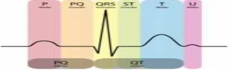 Gambar 1. Sinyal EKG Normal 