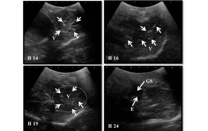 Gambar  2.  Gambaran  USG  transkutaneus  uterus  kambing  kacang  betina  lokal  yang  bunting  (H=  Hari  pascaperkawinan,  V= 