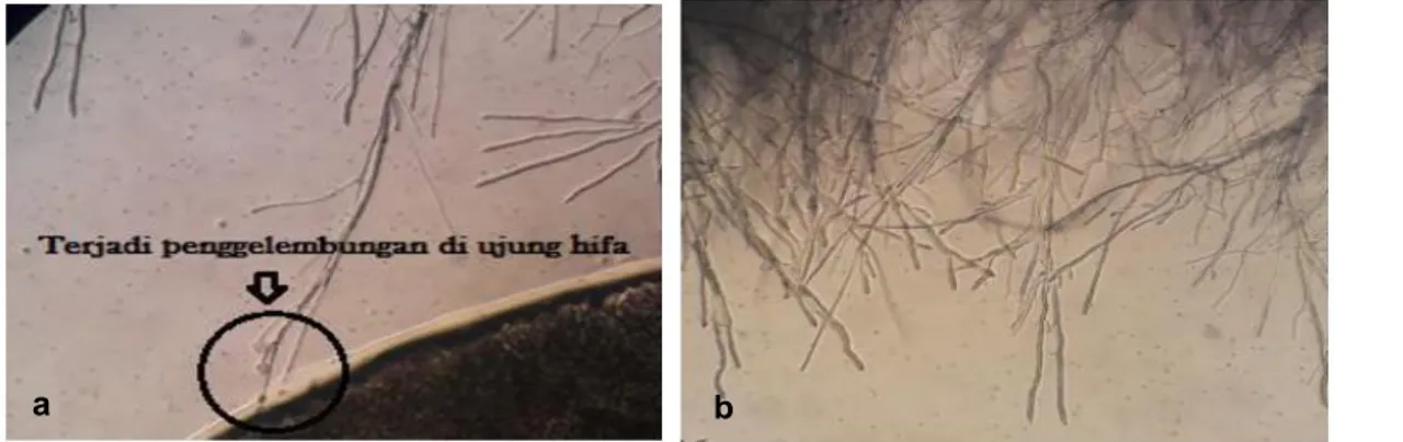 Gambar 6 Perubahan  morfologi  hifa  pada  pengamatan  dengan  mikroskop  cahaya  pada  pembesaran  400x:  a)  perlakuan  kitosan hifa menjadi menggembung/menggada dan b) perlakuan kontrol hifa normal
