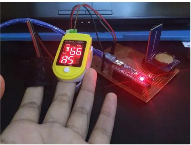 Gambar 9. Prosedur pengukuran detak jantung antara sistem berbasis  pulse heart rate sensor dan Oxymeter secara bersamaan pada dua jari tangan naracoba