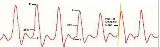 Gambar 2. Bentuk fisik pulse heart rate sensor (a) bagian depan dan (b) bagian belakang 