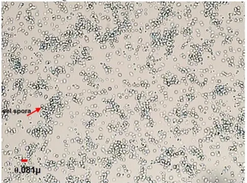 Gambar 2. Isolat Saccharomycees cerevisiae, perbesaran 400X, pewarnaan  laktofenol blue (Ahmad, 2008) 