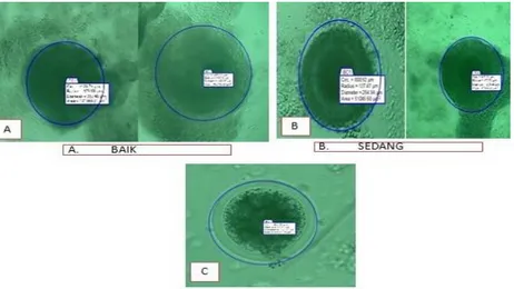 Gambar 2.  Diameter oosit dari ovarium sapi Bali Timor (a) oosit sapi Bali Timor               Kualitas Baik (b) oosit sapi Bali Timor kualitas Sedang (c) oosit sapi Bali         Timor kualitas Buruk  (gambar ini dilihat dan diukur dengan mikroskop  steros