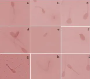 Gambar 1.   Bentuk normal dan abnormalitas spermatozoa sapi Aceh yang  diwarnai  dengan  eosin  negrosin  dan  diamati  menggunakan  mikroskop  cahaya  pembesaran  1000  ×