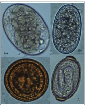 Gambar 1. Morfologi telur Echinostoma spp. (a), Ancylostoma  spp. (b), Toxocara spp. (c), dan Capillaria hepatica  (d)