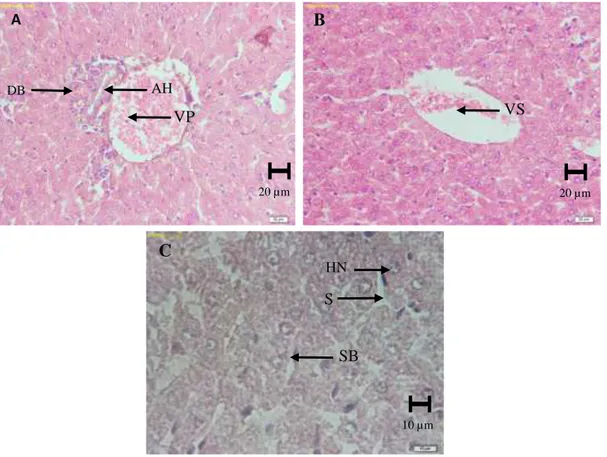 Gambar  2.  Gambaran  histologis  hepar  kelompok  kontrol  dengan  pewarnaan  HE.  (A  dan  B)  Perbesaran 400X, (C) Perbesaran 1000X