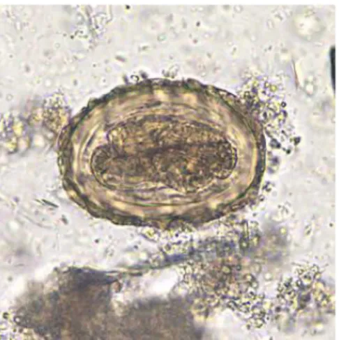 Gambar 1. Telur cacing Ascaris lumbricoides(Setya, 2014) 