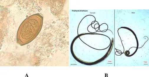 Gambar  4.  A:  telur  Trichuris  trichiura.  B:  cacing  dewasa  Trichuris  trichiura (Setya, 2014) 