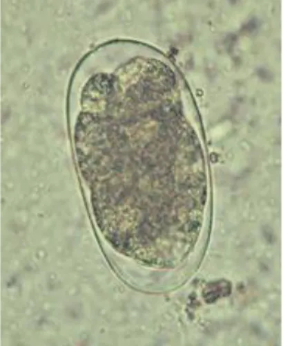 Gambar 6. Telur Hookworm(Setya, 2014) 