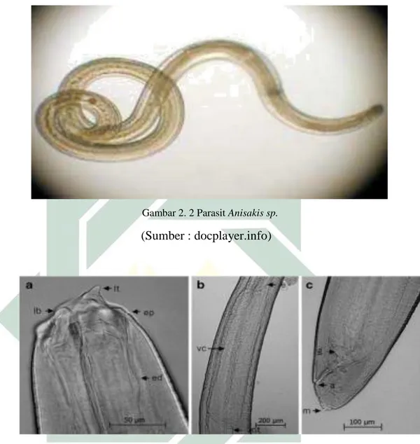 Gambar 2. 2 Parasit Anisakis sp.  (Sumber : docplayer.info) 