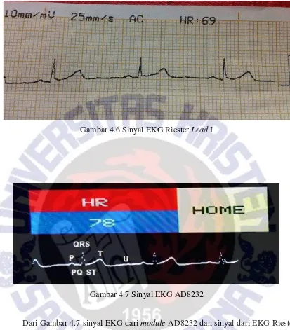 Gambar 4.6 Sinyal EKG Riester Lead I 