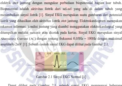 Gambar 2.1 Sinyal EKG Normal [1] 