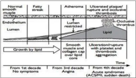 Gambar 2.7 Proses arterosklerosis Interaksi selular pada   Perkembangan dan progres arterosklerosis 