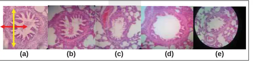 Gambar 10. Lung Tissue Preparation: (a) Negative control group; (b) s500; (c) s; (d) s; (e) s