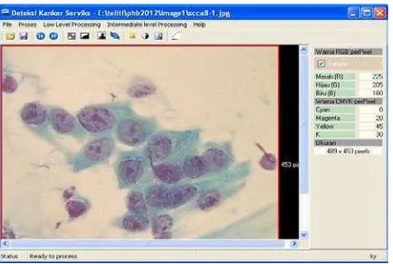 Gambar 2.7 Segmentasi inti sel pada pemeriksaan Pap Smear dengan kategori normal 