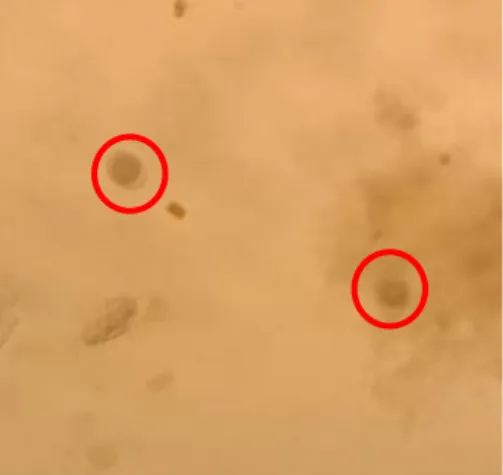Gambar 1 Hasil pemeriksaan natif telur Toxocara spp. pembesaran objektif 10x (lingkaran merah) 