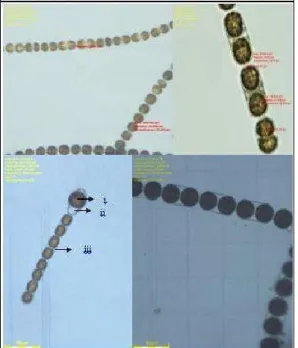 Gambar 2. Pengamatan sel Melosira sp.  di  bawah  mikroskop  DSX.  Perbesaran  10  x  10  (A), Perbesaran  40  x  10  (B),  Terminal  auxospore (i),  Mucilage (ii),  Pseudoculcus (iii), Pengamatan pada chamber hitung (D).