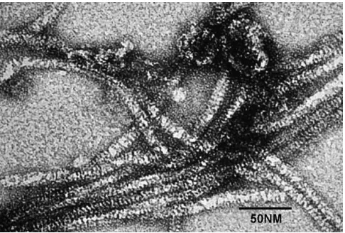 Gambar 2  Partikel PMWaV dibawah Mikroskop Elektron (CABI 2005). 