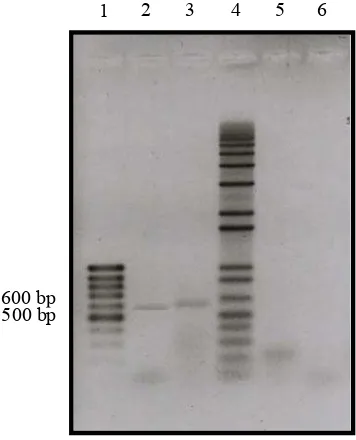 Gambar 6  Deteksi dan diferensiasi PMWaV-1 dan PMWaV-2 menggunakan RT-PCR. Lajur 1, 100 bp DNA ladder; lajur 2, tanaman terinfeksi PMWaV-1; lajur 3, tanaman terinfeksi PMWaV-2, lajur 4, 1 kb plus DNA ladder; lajur 5 dan 6, tanaman sehat