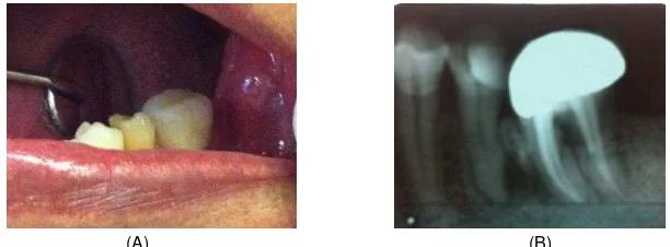 Gambar 5. (A) Pembuatan inti (B) Pembuatan tonggak (C) Pemilihan warna 