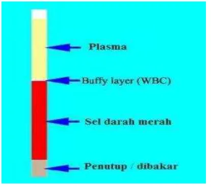 Gambar 2. Pengambilan darah kapiler 