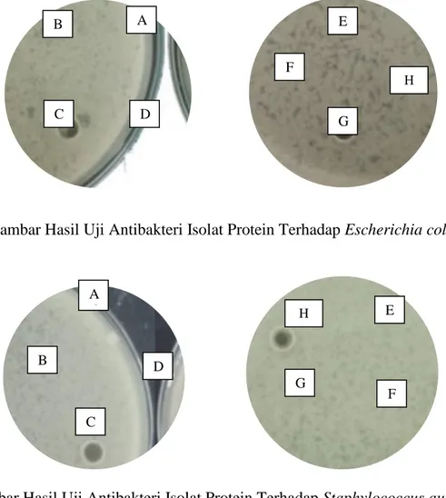 Gambar Hasil Uji Antibakteri Isolat Protein Terhadap Escherichia coli  