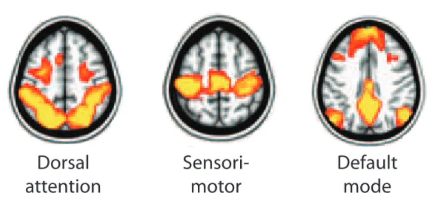 Figure 1: The dorsal attention, sensorimotor and default mode networks. Figure