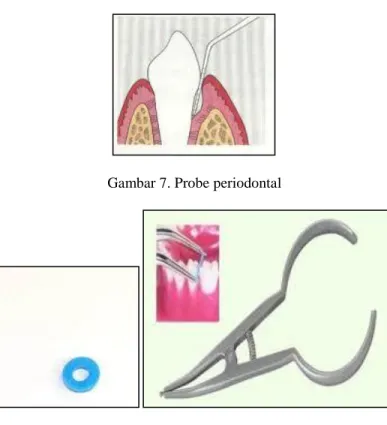Gambar 7. Probe periodontal 