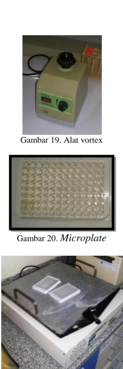 Gambar 19. Alat vortex 