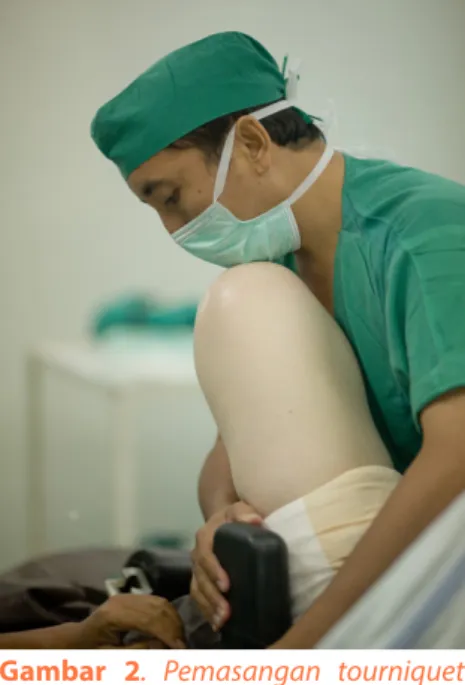 Gambar 2. Pemasangan tourniquet  sebagai bagian dari proses persiapan  operasi penggantian sendi lutut.