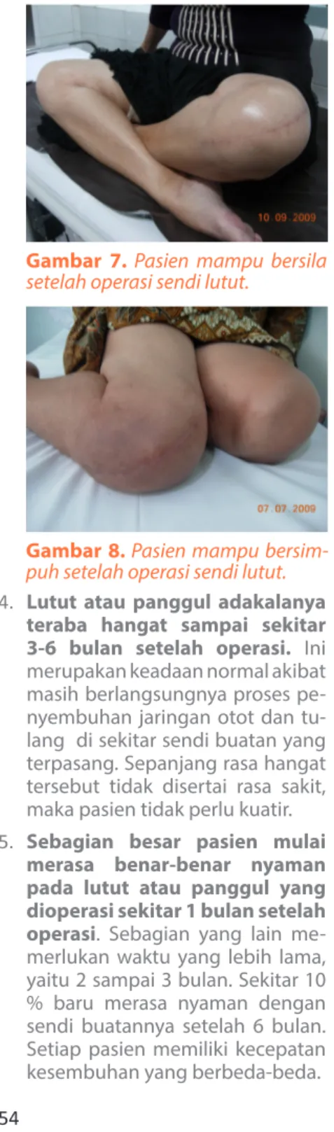 Gambar 8. Pasien mampu bersim- bersim-puh setelah operasi sendi lutut.