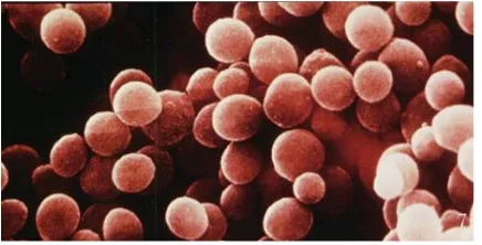 Gambar 1. Staphylococcus aureus yang Dilihat dari Mikroskop Elektron.