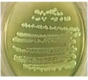 Gambar 1: (a) Kontrol negative, (b) Kontrol positif