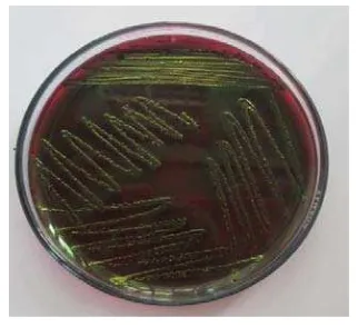 Gambar 4.1.2.1 Bakteri Escherichia Coli 