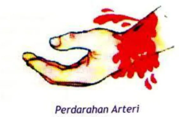 Gambar 4. Cedera Perdarahan 