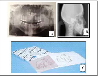 Gambar 11. Bahan yang digunakan. (A) Foto panoramik, (B)Sefalogram lateral, (C) Kertas asetat (0.003 inchi)