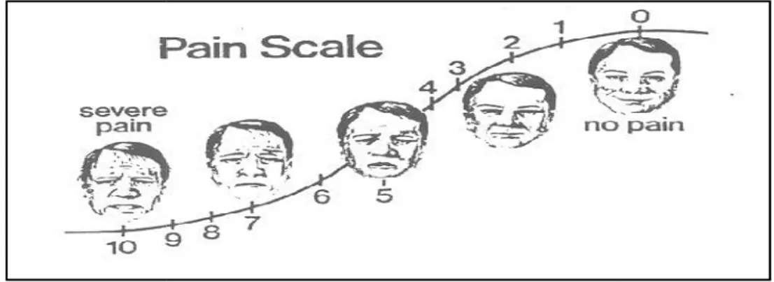 Gambar 4. Visual Analogue Scale. 28