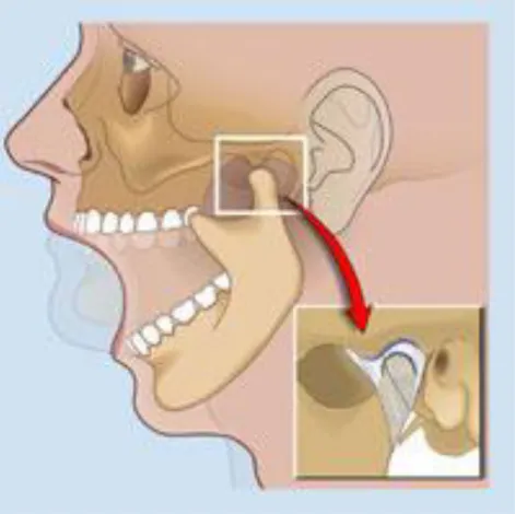 Gambar 9 : TMJ ( temporo mandibular joint ) 