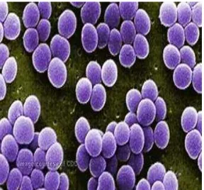 Gambar 2.2 Bakteri Staphylococcus aureus (Nasution M, 2014) 