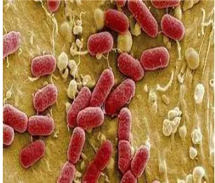 Gambar 2.3. Bakteri Salmonella typhi (Pelczar, dkk, 2005) 