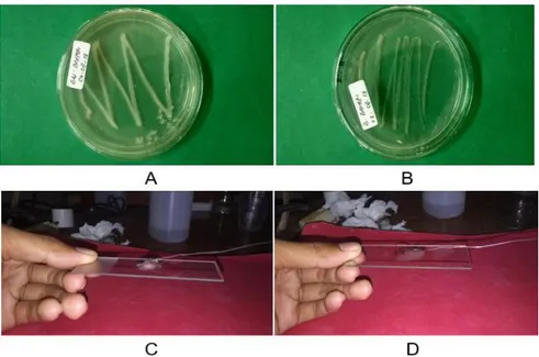 Gambar  3.  Bakteri  pada  tanaman  buah  naga  :  (A)  bakteri  gram  negatif  pada  media  NA  (natrium  agar),  (B)  bakteri  gram  positif  pada  media  NA  (natrium  agar),  (C)  pengujian  KOH  3%  menunjukkan  gram  negative,  (D)  pengujian  KOH  3