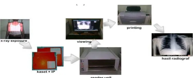 Gambar 4. Proses / Cara Kerja Computer Radiografi. 