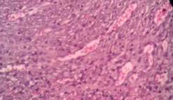 Gambar  3.  Gambar  Angiogenesis  (a),  kolagen  (b),  dan  sel fibroblas. (pewarnaan HE, 40X) 